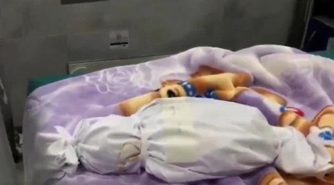 غزة: ارتفاع عدد الأطفال المتوفين بسبب سوء التغذية لـ 16